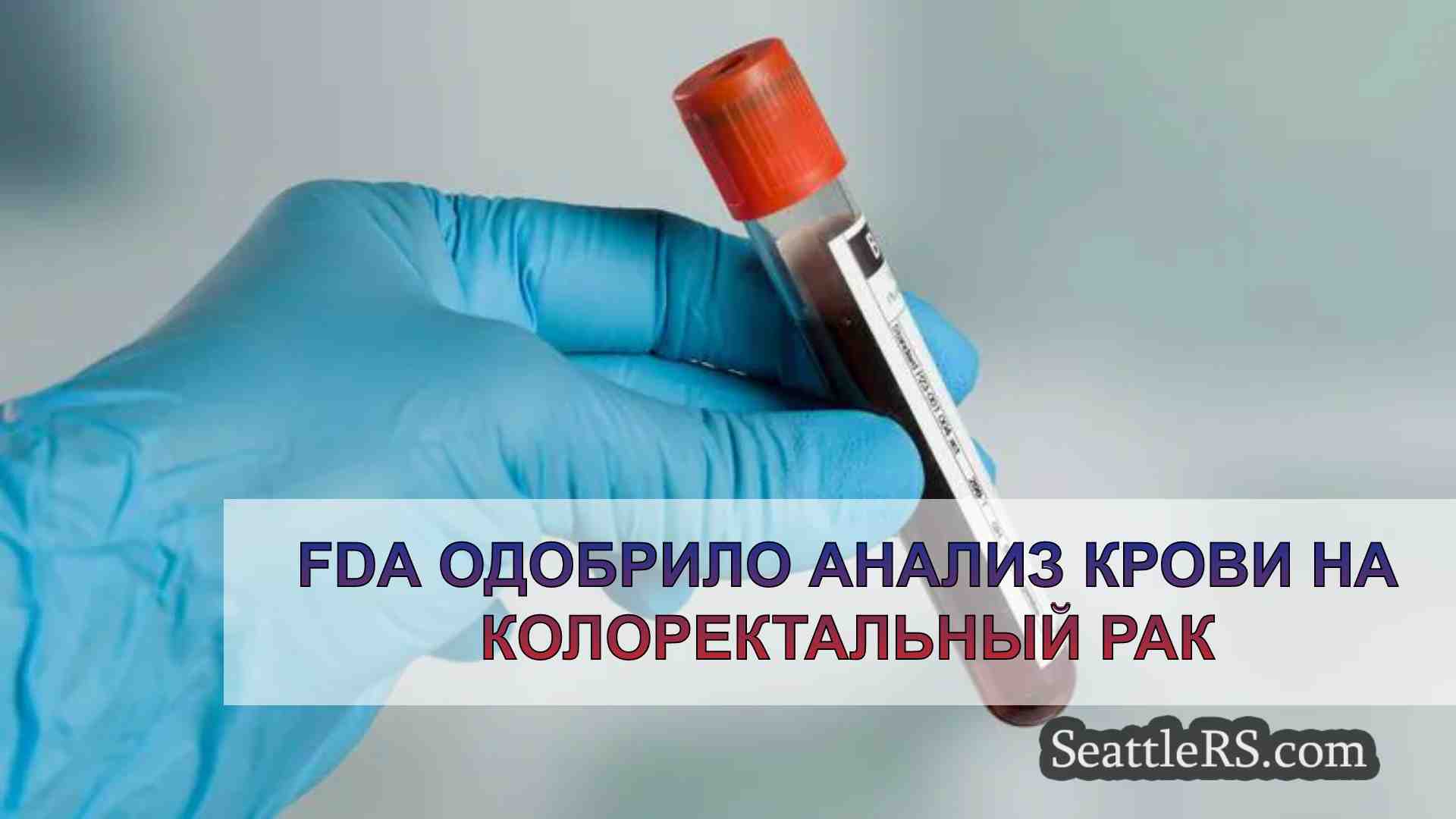 FDA одобрило анализ крови на