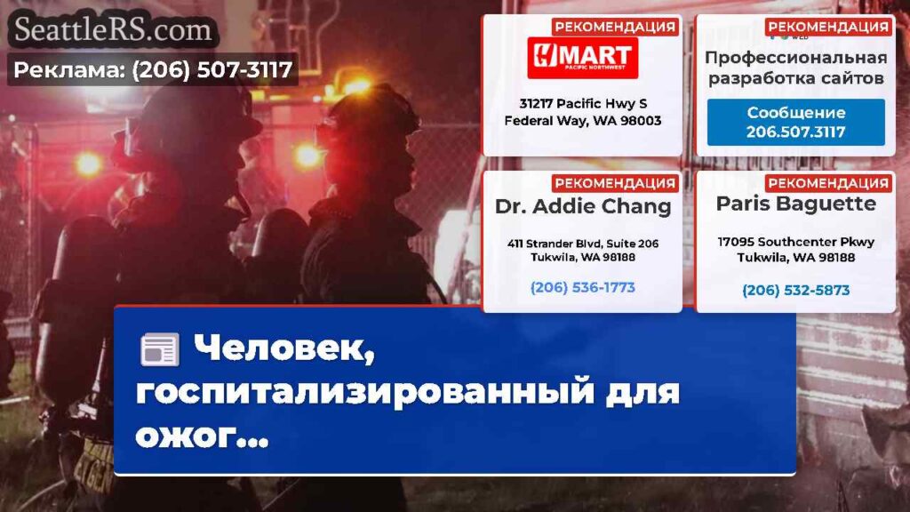 Человек, госпитализированный для ожог...