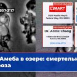 Амеба в озере смертельная угроза