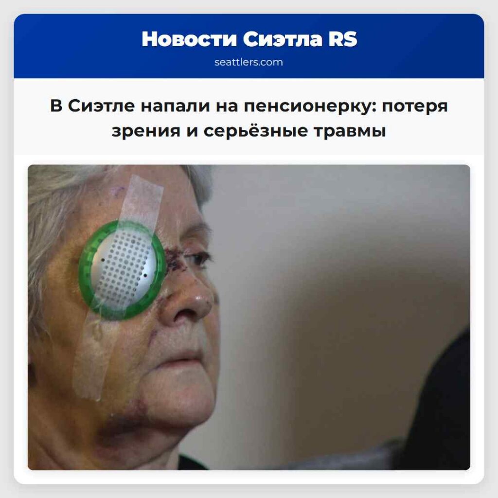 В Сиэтле напали на пенсионерку: потеря зрения и