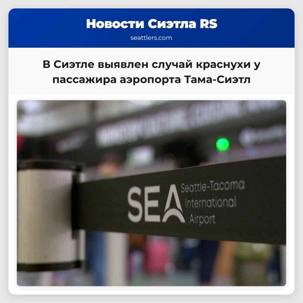 В Сиэтле выявлен случай краснухи у пассажира