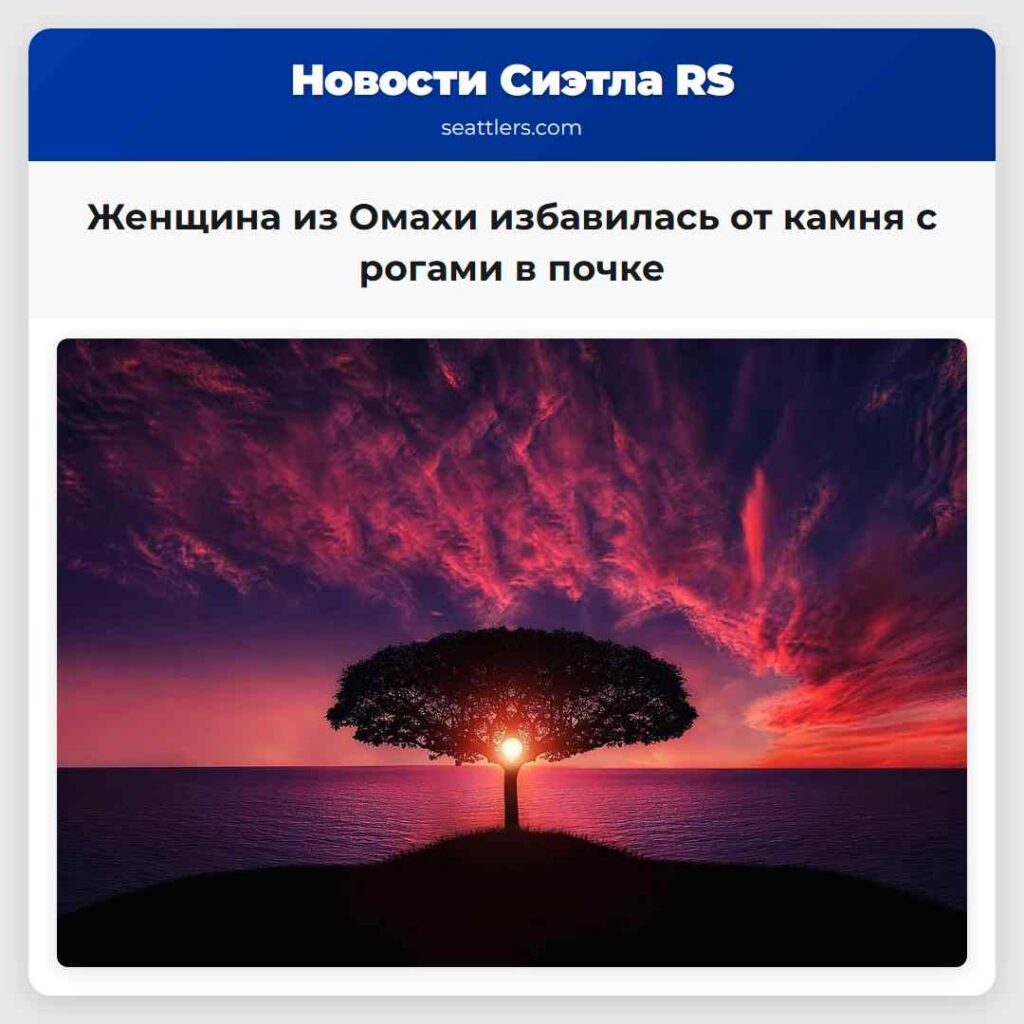 Женщина из Омахи избавилась от камня с рогами в