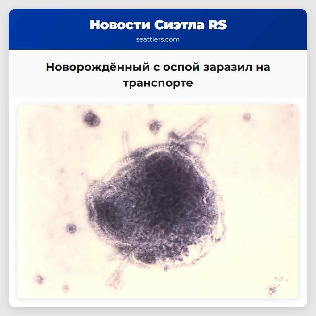 Новорождённый с оспой заразил на транспорте